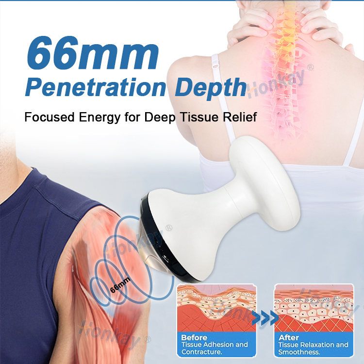 focused shockwave therapy machine cost