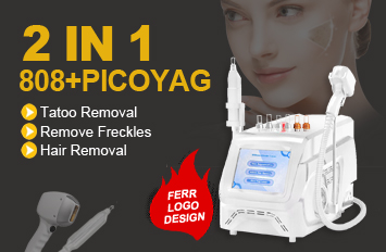 3 wavelength laser hair removal machine