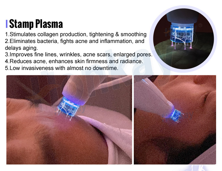 stamp plasma