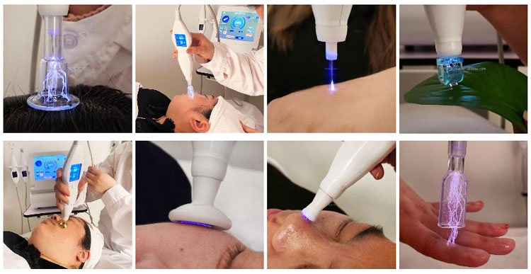 plasma pen professional